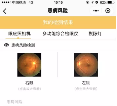 星創(chuàng)視界聯(lián)手春雨醫(yī)生，眼鏡店或成在線問(wèn)診大入口