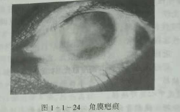初級(jí)驗(yàn)光師培訓(xùn)知識(shí)點(diǎn)：影響視覺(jué)的原因分析