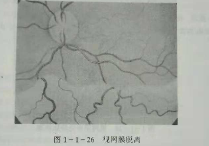初級(jí)驗(yàn)光師培訓(xùn)知識(shí)點(diǎn)：影響視覺(jué)的原因分析
