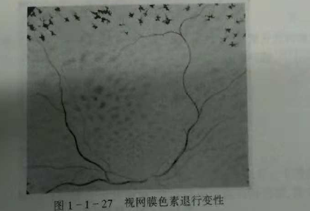 初級(jí)驗(yàn)光師培訓(xùn)知識(shí)點(diǎn)：影響視覺(jué)的原因分析