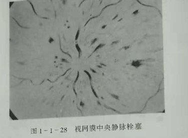 初級(jí)驗(yàn)光師培訓(xùn)知識(shí)點(diǎn)：影響視覺(jué)的原因分析