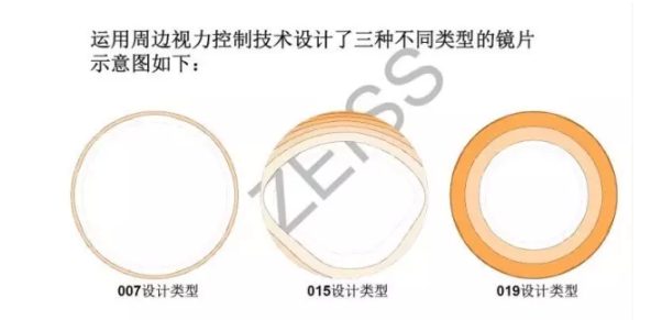 【驗(yàn)光師分享】環(huán)焦、全焦和離焦這3種鏡片有什么區(qū)別？