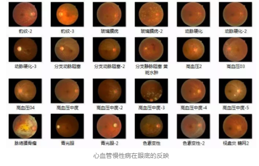 視光變革者寶島眼鏡CEO王智民：AI是慢性病、近視防控救星