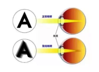 東莞驗(yàn)光師考證培訓(xùn)散光如何正確應(yīng)對(duì)？