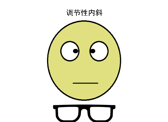 驗(yàn)光配鏡中遇到的20多種斜視眼位特點(diǎn)