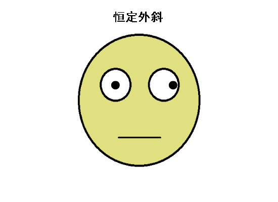 驗(yàn)光配鏡中遇到的20多種斜視眼位特點(diǎn)