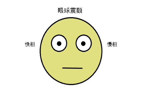 驗(yàn)光配鏡中遇到的20多種斜視眼位特點(diǎn)