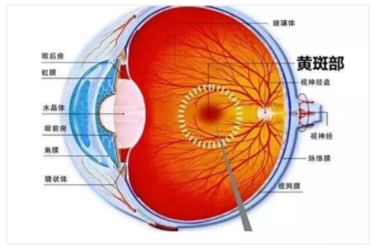 【驗光師培訓科普】一組圖告訴你的眼底還健康嗎？